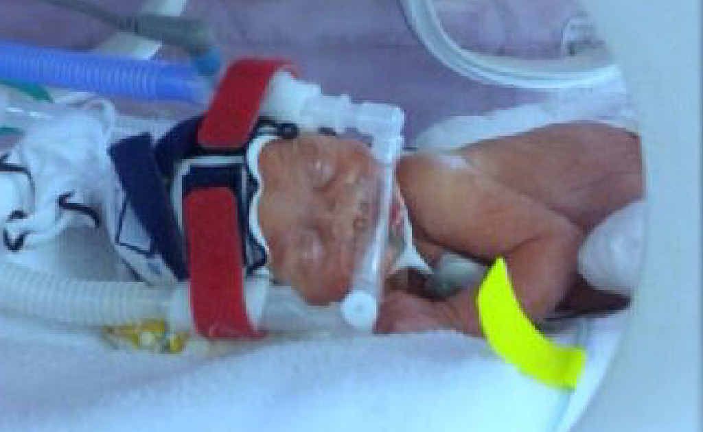 Baby Ella Jane Le-Brocq shocked her parents last month when she entered the world 13 weeks early. Baby Ella Jane Le-Brocq shocked her parents last month when she entered the world 13 weeks early.